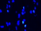 A Good Astrocyte Marker in the Optic Nerve - Abcam