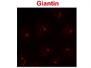 A Good Abcam Antibody for Staining Giantin