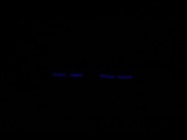 Very Good Calbindin Antibody from CST
