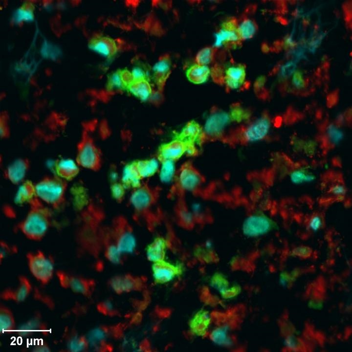 LCH cells