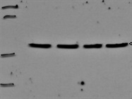 Right Beta Tubulin Antibody from Abcam