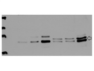 A Good Anti-S6K1 Antibody for Immunodetection in Human Cells