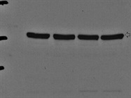 Detection of CD36 in Human Endothelial Cells