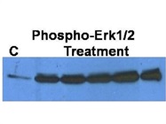 Excellent Antibody to Detect Phospho-Erk1/2 Protein by Western Blot (CST)