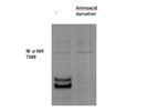 CST Antibody Against Phospho-p70 S6 Kinase Works Very Well