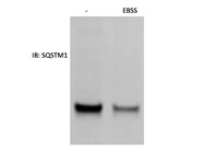 Most Sensitive SQSTM1 Antibody I've Tried (Abnova)