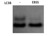Very Sensitive Mouse LC3B Specific Antibody from MBL International