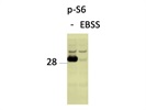 Very Strong Signal for Phospho-S6 Ribosomal Protein!
