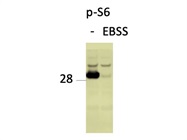 Very Strong Signal for Phospho-S6 Ribosomal Protein!