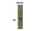 Very Sensitive BECN1 Antibody from CST
