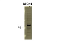 Very Sensitive BECN1 Antibody from CST