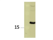 Highly Sensitive REEP5 Antibody from Proteintech