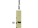 Very Strong Tubulin Antibody from Abcam