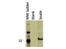 One of the Strongest Antibodies against CALR from CST