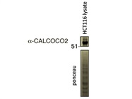 Strong Antibody for Autophagy Receptor CALCOCO2