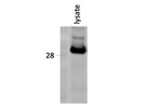 Super Strong RPS6 Antibody from CST