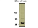 Highly Sensitive and Specific Antibody against RPS3