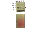 Lots of Background Bands from This NUFIP1 Antibody