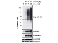 Use of Recombinant Ubiquitin for In-Vitro Assays