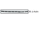 Immunoblotting of ß-Actin for Loading Control