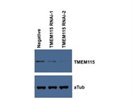 Excellent TMEM115 Antibody from Atlas Antibodies