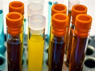 Detecting and Decoding Exosomes