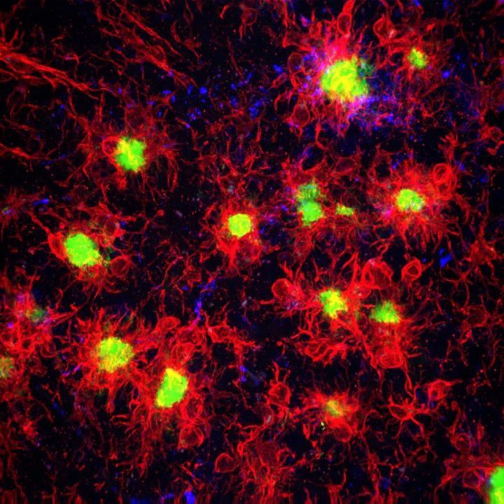 microglia