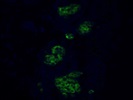 Strong Staining in Mouse Embryonic Pancreas