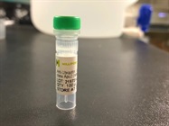 Time Course Effect of Chemoattractant on Ubiquitination