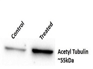 Acetyl Tubulin Levels Using Anti-Alpha Tubulin Antibody