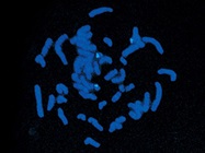 VECTASHIELD® with DAPI
