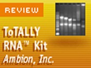 Ambion’s ToTally RNA kit