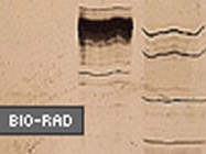 Bio-Rad's Silver Stain Kit