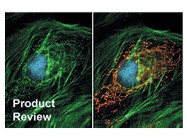 ProLong® Gold Antifade Reagent From Invitrogen