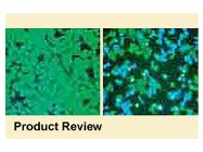 Lipofectamine™ 2000 from Invitrogen