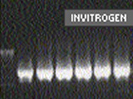 Invitrogen Platinum's Taq DNA Polymerase High Fidelity 