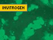 Invitrogen's Lipofectamine 2000 
