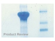 Pierce's SeizeX Immunoprecipitation Kit