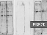 Pierce’s Restore Western Blot Stripping