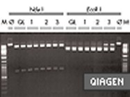 QuickLyse Miniprep Kit From Qiagen