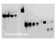 The DIG RNA Labeling Kit SP6/T7 From Roche 