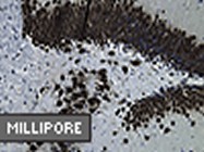 Mouse-to-Mouse IHC Detection Kit From Millipore