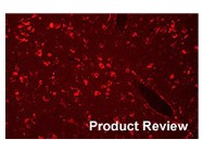 Chemicon’s Autofluorescence Eliminator Reagent