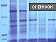 Chemicon's Compartmental Protein Extraction Kit