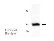 Rac1 Activation Assay Kit From Upstate