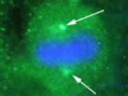 Rabbit Polyclonal Anti-Pericentrin Antibody from Covance, used in Indirect Immunofluorescence