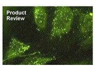 Human Lung Microvascular Endothelial Cells (HMVEC-Ls) From Lonza