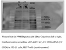 This PPM1D Antibody Failed to Bind the Protein