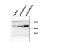 Western Blot of Glioma Stem Cell Lysates with Myc-Specific CST Antibody