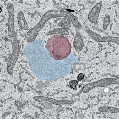 lysosomes
